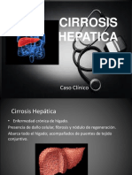 Cirrosis hepática