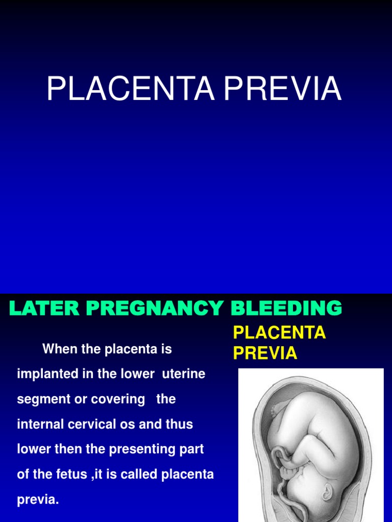 Placenta Previa And Placental Abruption Placenta Childbirth