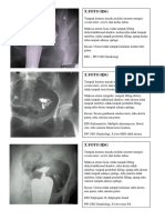 Radiologi HSG