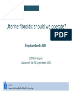 Uterine Fibroids: Should We Operate?: Stephan Gordts MD