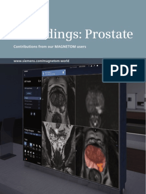 prostate mri protocol siemens)