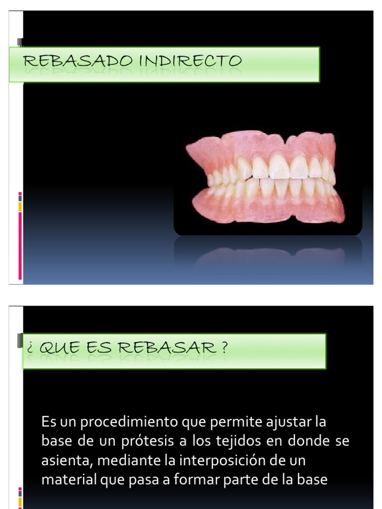 Rebase en Prótesis Dental Total | PDF