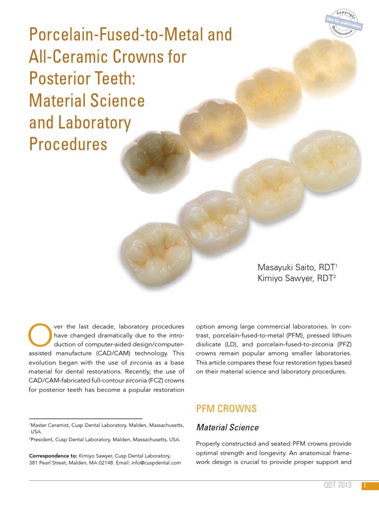 PorcelainFusedtoMetal and AllCeramic Crowns For Posterior Teeth Material Science and