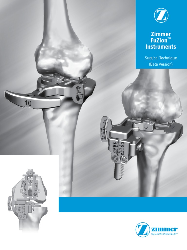 Zimmer Fuzion Instruments Surgical Technique Beta Version PDF PDF