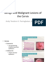 1 Benign and Malignant Lesions of The Cervix