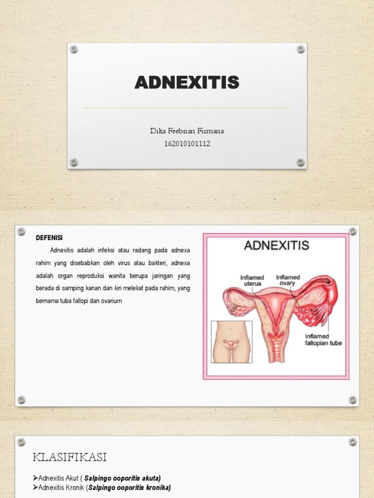 Adnexitis | PDF