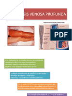 Trombosisvenosaprofunda 140209204042 Phpapp01 PDF