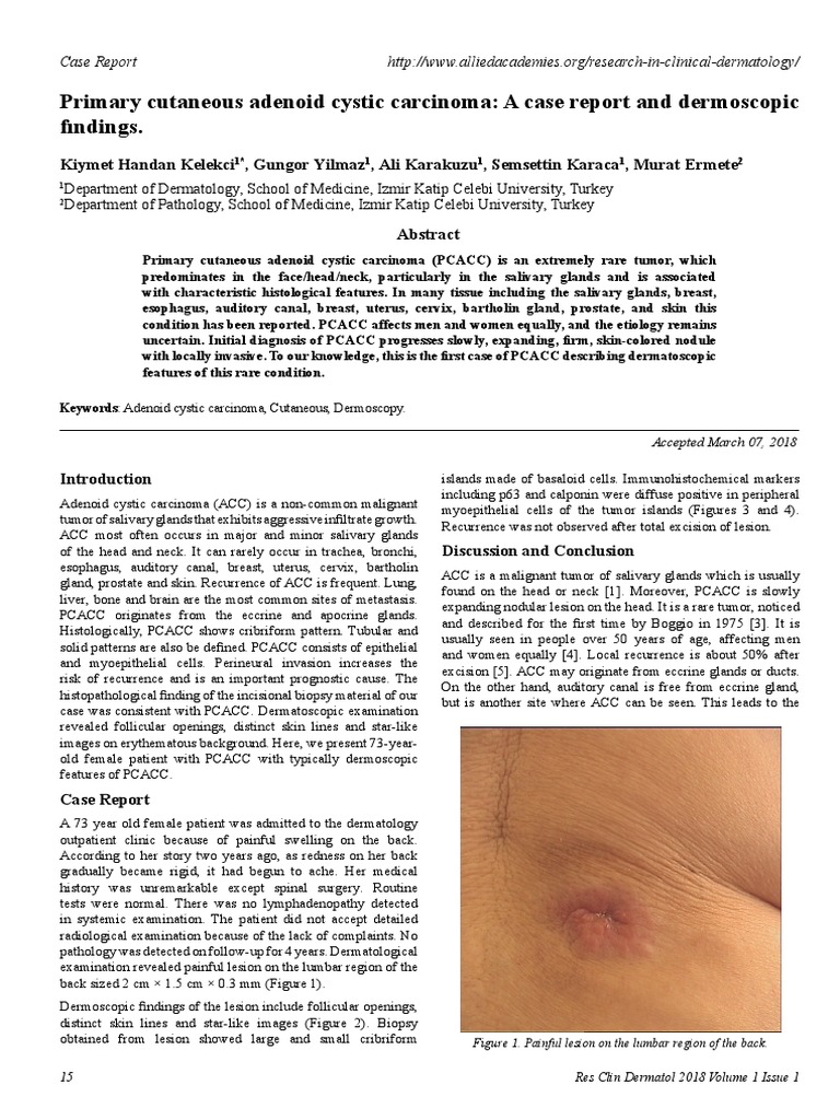Primary Cutaneous Adenoid Cystic Carcinoma Case Study | PDF | Carcinoma ...