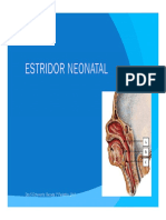 Estridor Neonatal PDF