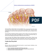 Neuroma