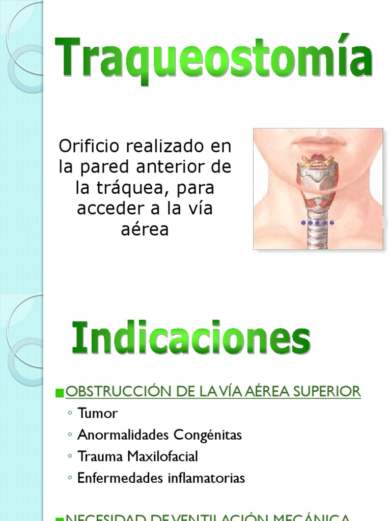 Indicaciones Y T cnica De Traqueostom a PDF
