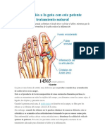 GOTA con este potente tratamiento natural.docx