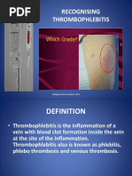 Teaching Slide Recognising Thrombophlebitis