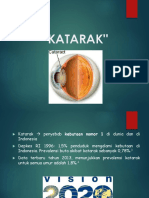 Katarak