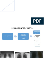 pembacaan thorax