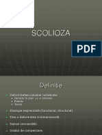 Scolioza