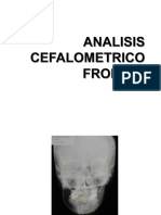 Analisis Cefalométrico Frontal