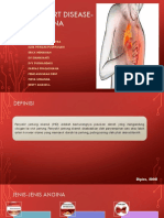 Angina FIX-1