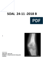 soal 24-11-2018 B jawab