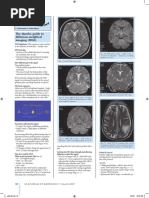 The Dumbo Guide To Diffusion-Weighted Imaging (DWI) : C Ackermann, S Andronikou