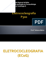 Eletrococleografia 