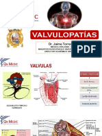 Valvulopatías: Estenosis Mitral, Insuficiencia Aortica