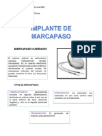 Implante de Marcapasos