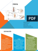 Osteoartritis