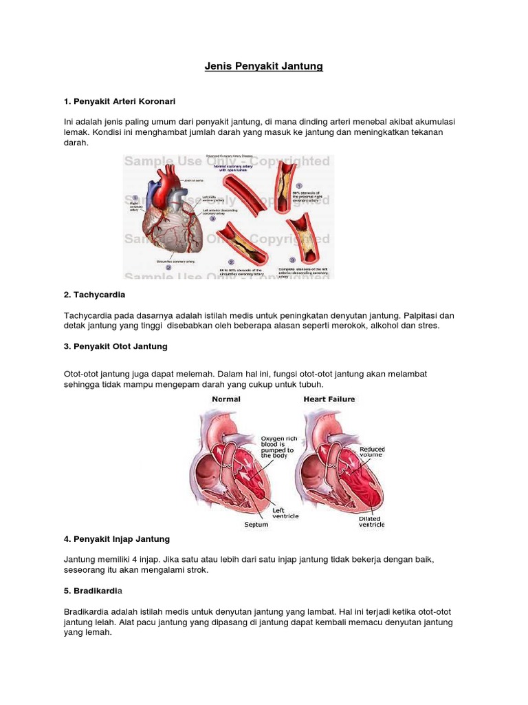 Jenis Penyakit Jantung Tingkatan 3 Pdf