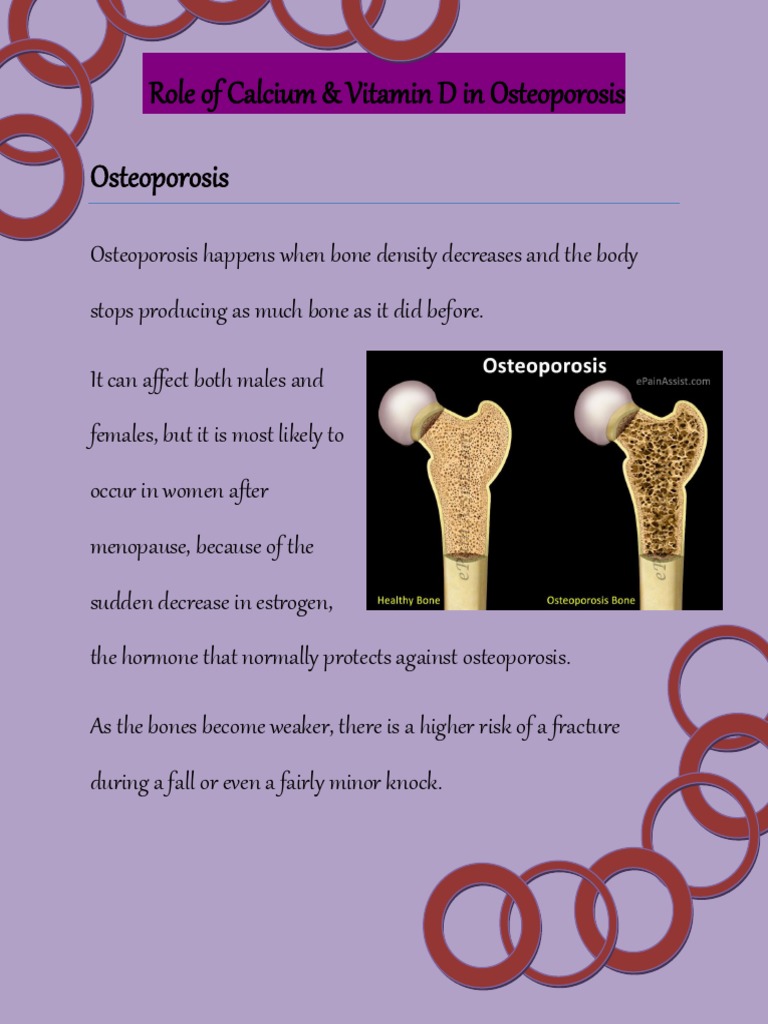 Role of Calcium & Vitamin D in Osteoporosis Osteoporosis | PDF ...