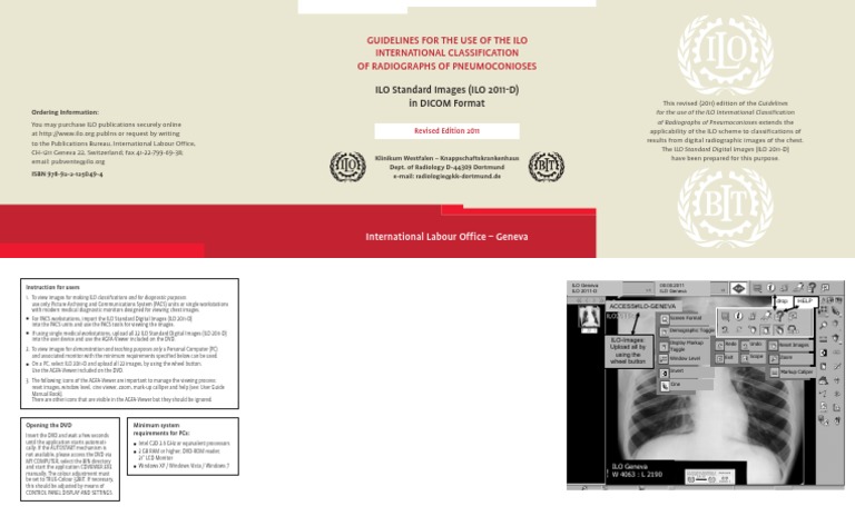 ILO Guidelines for Radiographs of Pneumoconioses | PDF | Microsoft ...