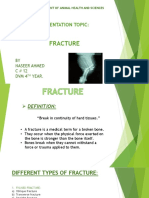 Fracture..... Pptx... Presentation