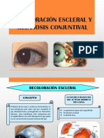 Decoloración escleral y melanosis conjuntival: causas, síntomas y tipos