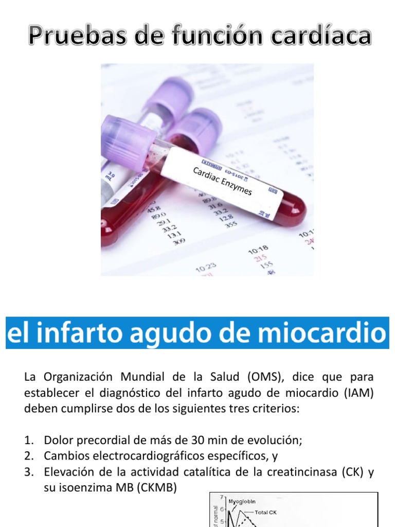 Pruebas de Función Cardíaca | Infarto de miocardio | Isquemia