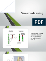 Sarcoma de Ewing