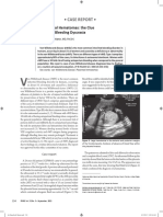 Case Report - : Fetal Surface Placental Hematomas: The Clue in The Diagnosis of A Bleeding Dyscrasia