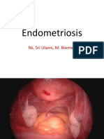 Endometriosis Ut