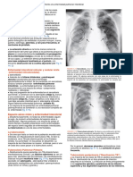 Radiografia de Torax