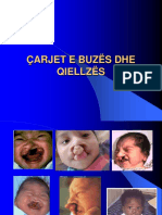 Carjet e Buzve