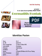 Dermatitis Kontak Iritan