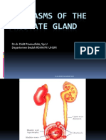 Neopasms of The Prostate Gland