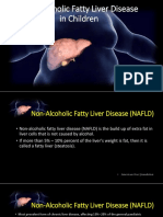 Non-Alcoholic Fatty Liver Disease in Children: - DR CSN Vittal