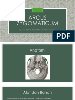 Arcus Zygomaticum