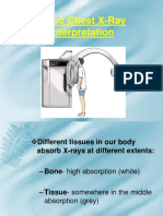 Basic Chest X-Ray Interpretation (1)