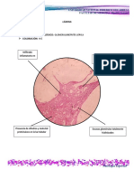 Pliquistico Renal