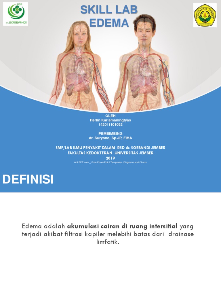 Mastering Edema Essential Nursing Diagnosis Skills - gcxy9pg