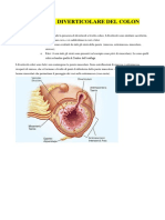 Diverticolite