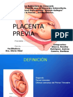 Placenta Previa 