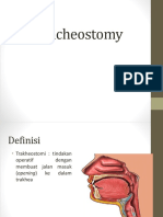 To Tracheostomy