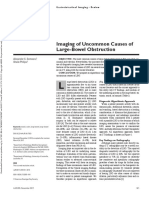 Imaging of Uncommon Causes of Large-Bowel Obstruction: Alexander S. Somwaru Shaile Philips